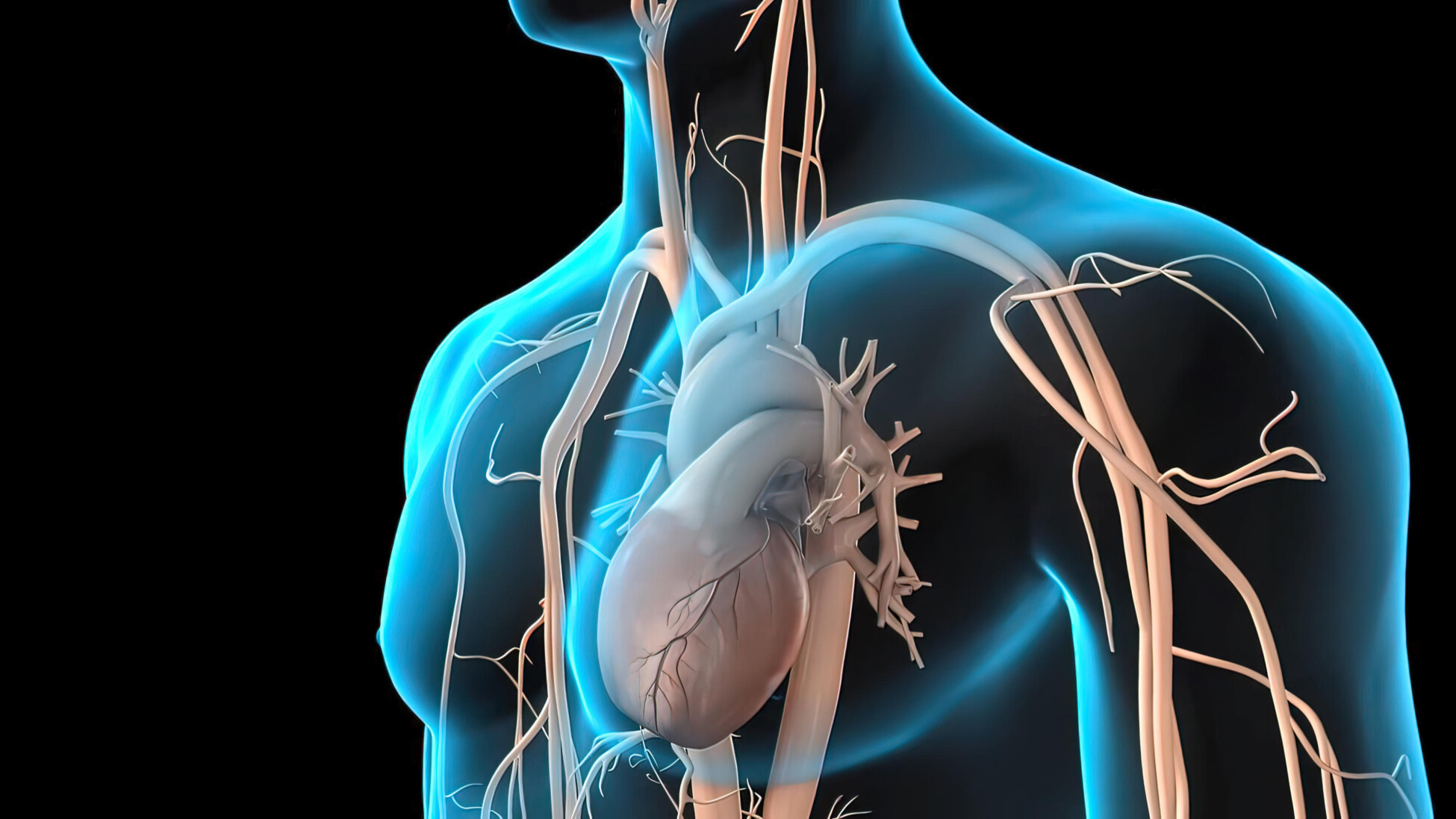 Aortic pathology